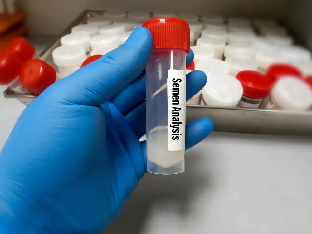 Discreet & Accurate Semen Analysis Test at Home in Dubai Life Aid